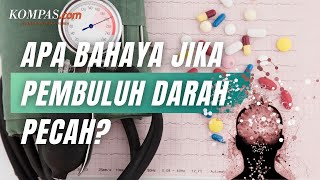 Apakah Pecah Pembuluh Darah Berisiko Stroke? Ini Ulasannya