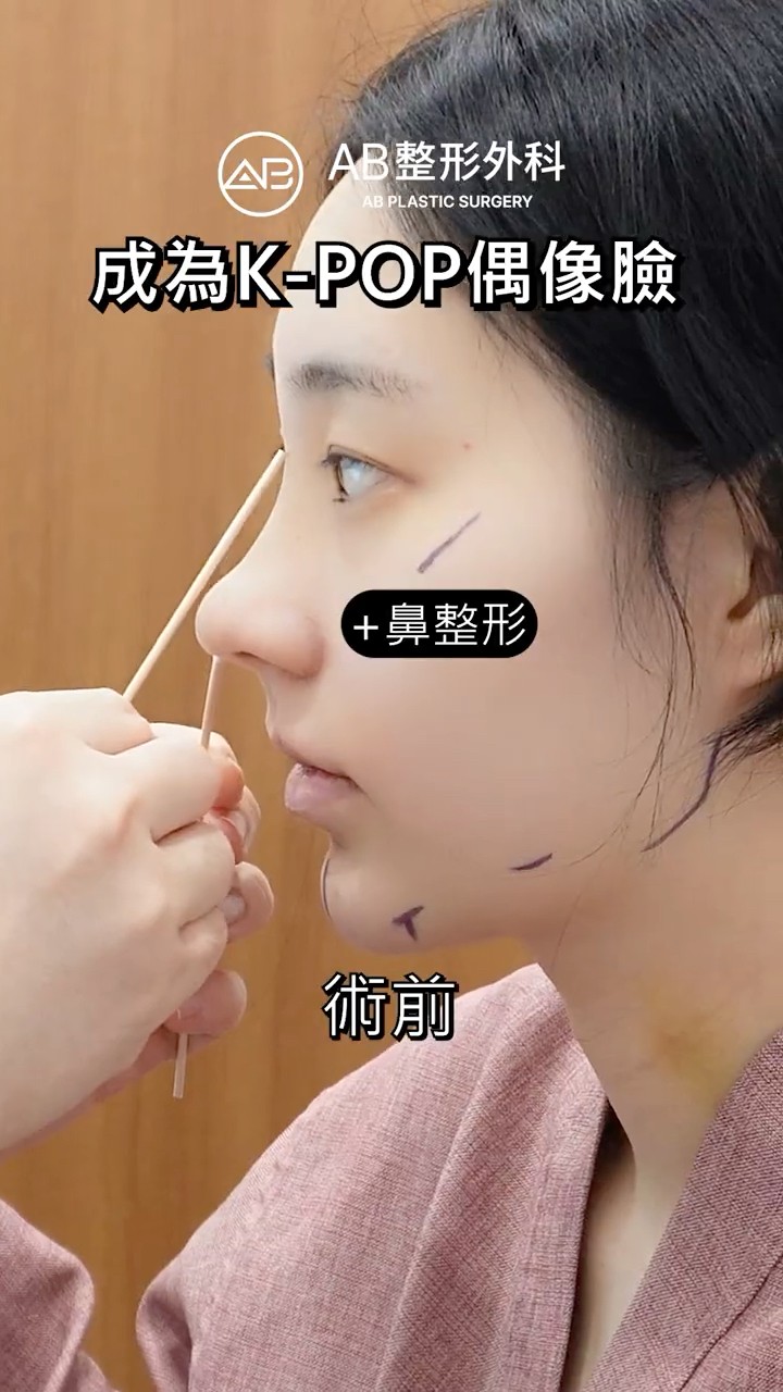 一次提升整個氣質：眼鼻輪廓全套術後差太多 #shorts