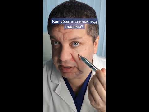 Как быстро избавиться от синяков под глазами? - YouTube