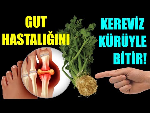 Video: Kereviz Bitkileri Kalın Değildir - Kereviz Saplarının Çok İnce Olmasının Nedenleri