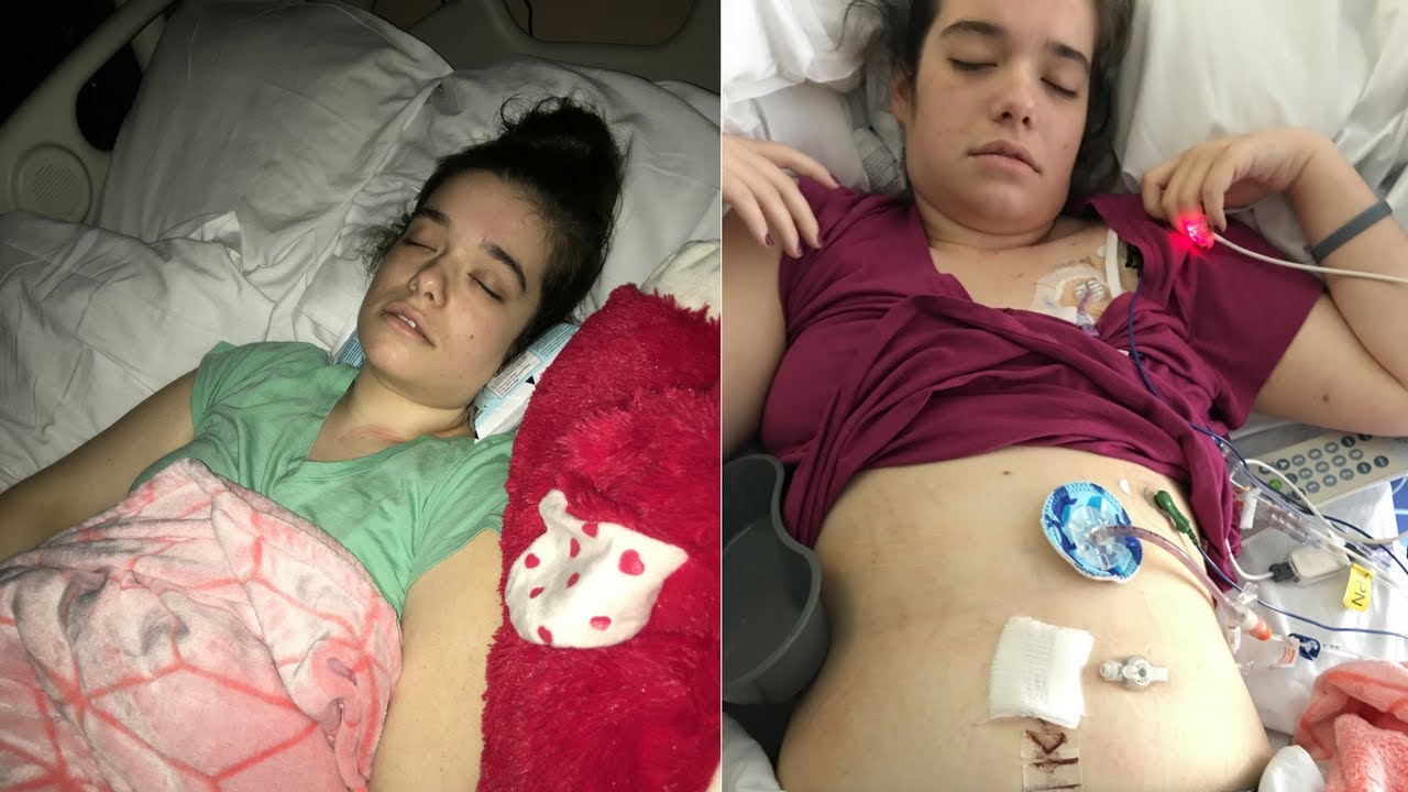 Recovering from JTube Surgery! (6/2730/2017) YouTube