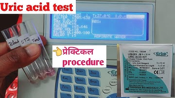 Uric acid test in hindi | Uric Acid test practical | Uric Acid test #dmlteducationpoint