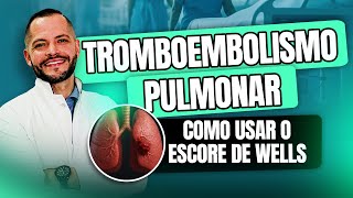 Escore De Wells No Tromboembolismo Pulmonar