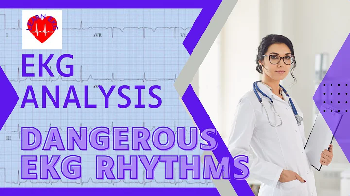 5 Dangerous and Lethal EKG Rhythms