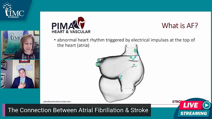 The Connection Between Atrial Fibrillation & Stroke
