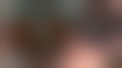 Synechiae & Small Pupil Cataract Surgery solved with the B-Hex ring