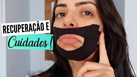 O que comer depois de uma bichectomia?