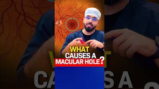 What causes a Macular Hole?