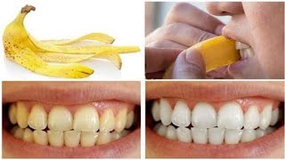 كيفيه تبييض الأسنان بياض دائم باستخدام قشر الموزوالنتيجه في منتهي الروعه️