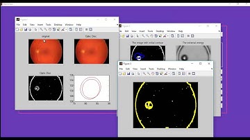 Visual technique image segmentation matlab projects