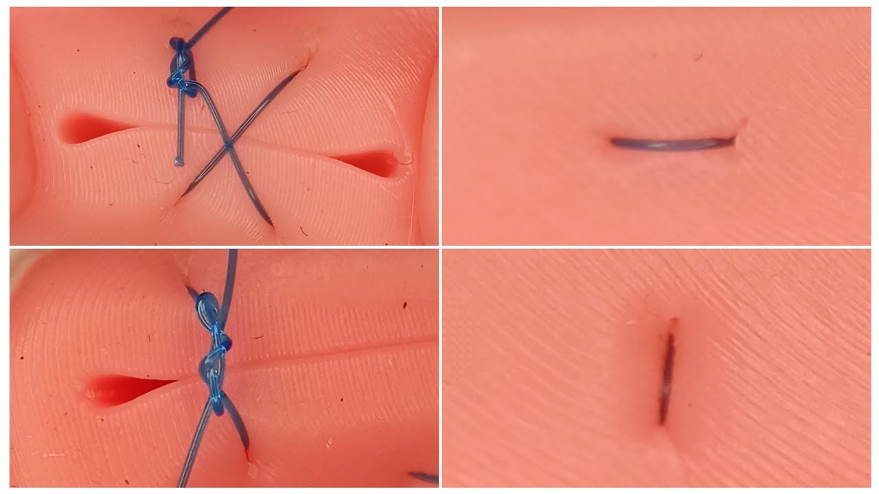 dental suturing techniques (simple intrrupted, figure of 8