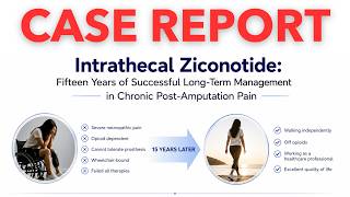 Intrathecal Ziconotide For Chronic Postamputation Pain: 15 - Year Case Study Analysis