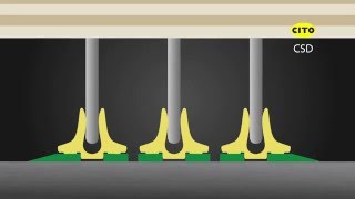 Cito - Csd