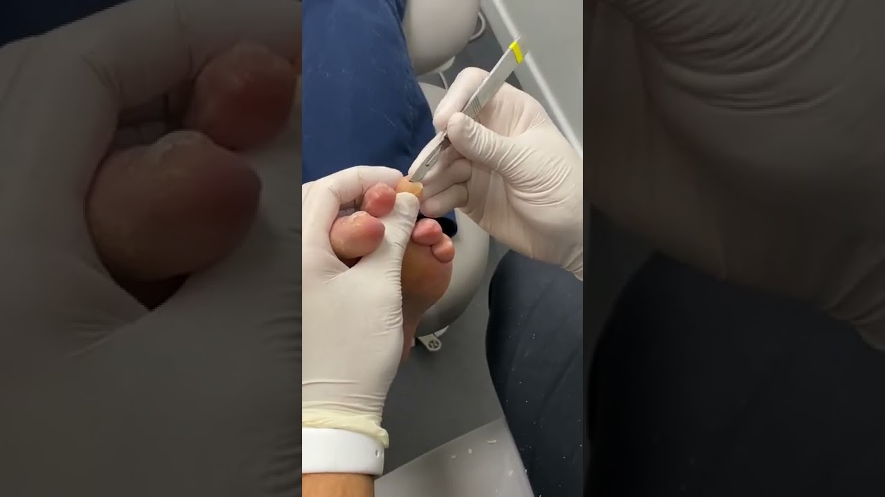 ¿En qué áreas de la podología se especializa Aranzazu Requena Martinez?