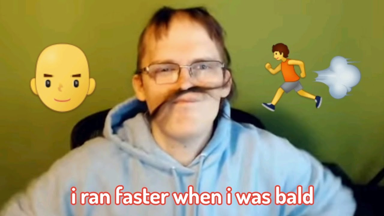 badboyhalo shares his experience with being bald