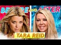 Tara Reid  | Before &amp; After | Transformation After Multiple Surgeries?