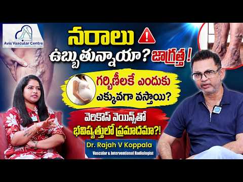 Avis Hospital | Dr. Rajah V Koppala Interview | Varicose Veins Treatment | iDream Media - IDREAMMEDIA
