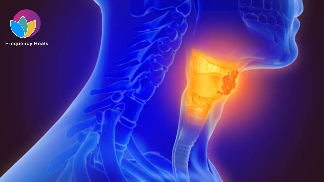 Larynx Polyp Treatment Remove the Polyp & Protect the Vocal Cord and