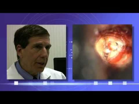 Interview with Dr. Mark Levenson - Ear Surgery