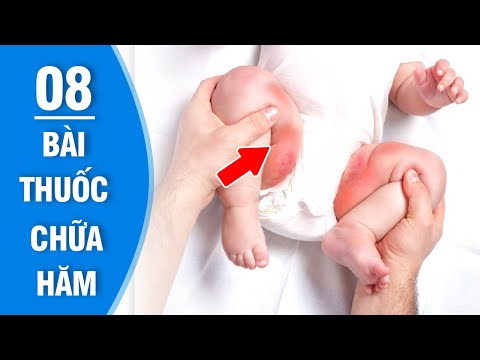 8 bài thuốc dân gian chữa hăm tã cho bé cực kỳ hiệu quả