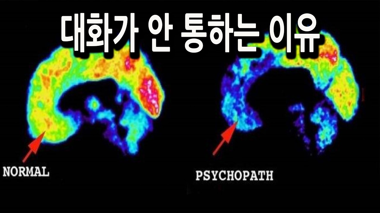 사이코패스는 태어나는 걸까, 만들어지는 걸까?