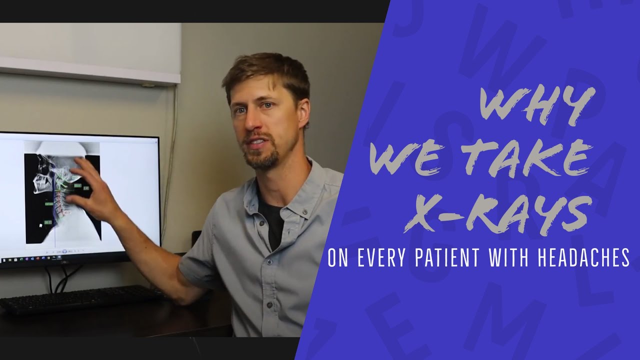 Why We Take X Rays On EVERY Patient With Headaches | Chiropractor for Headaches in Spokane Valley, W