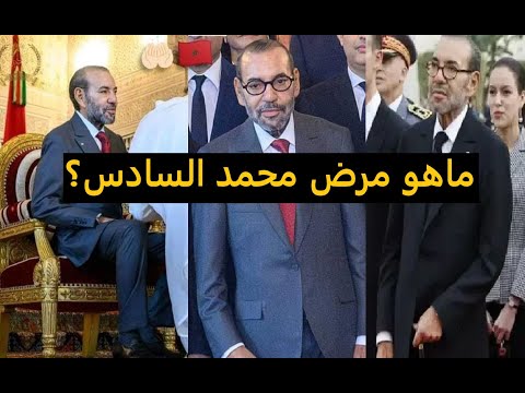 نحيل وعلى ع ك از ماهو مرض محمد السادس الذي أثار ذهول الكثيرين