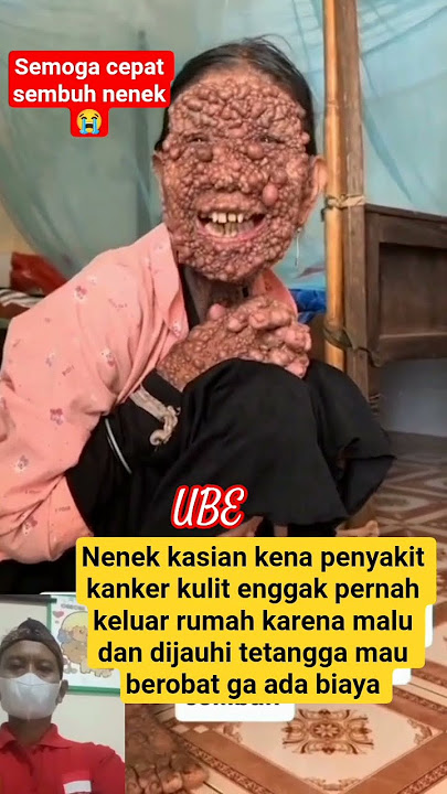 Grandma has a poor skin disease and is shunned by her neighbors #shorts #sadshorts #lifemotivation