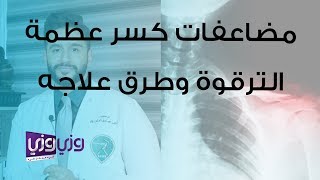 مضاعفات كسر عظمة الترقوة وطرق علاجه