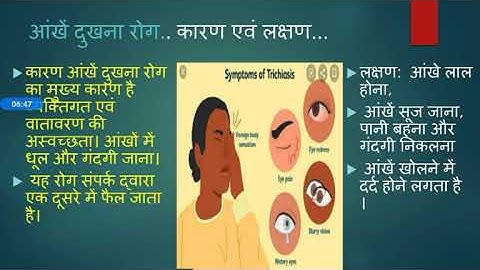 Part-3 video for Class-8(homescience )Chapter -1 (Sadharan Rog) l