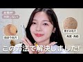 【いちご鼻必見】本当に効いたブラックヘッドや角質の除去方法をお教えします📝