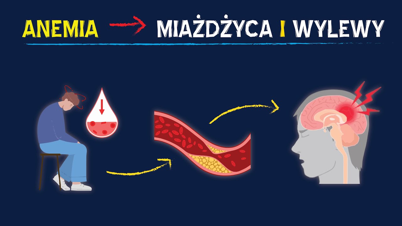 Anemia = MIAŻDŻYCA i zakrzepy. Jak anemia prowadzi do problemów z układem sercowo-naczyniowym.