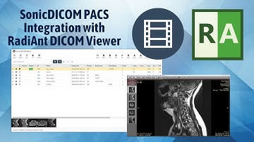 SonicDICOM PACS integration with RadiAnt DICOM Viewer