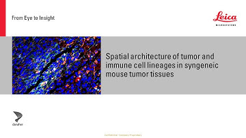Spatial architecture of tumor and immune cells in tumor tissues