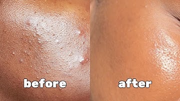 how to get rid of textured skin | good molecules pm skincare routine