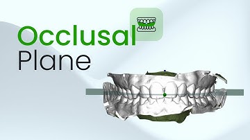 Setting Up the Occlusal Plane in SmileInspector