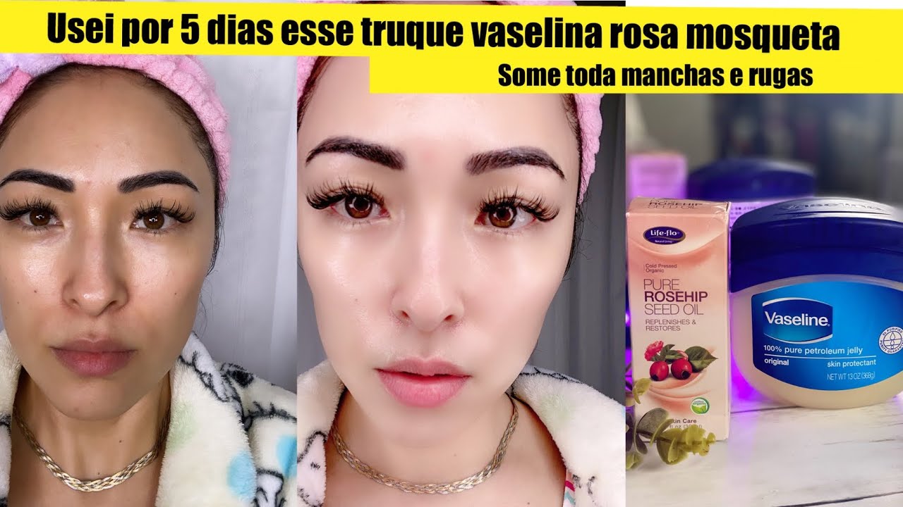 TRUQUE DA VASELINA USANDO EM 5 DIAS CLAREIA MANCHA DEIXA A PELE DE ...