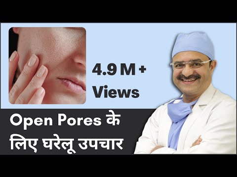 12 Home Remedies For Open Pores (Open Pores के लिए घरेलू उपचार) | ClearSkin, Pune | (In HINDI)