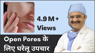 12 Home Remedies For Open Pores (Open Pores के लिए घरेलू उपचार) | 2023 | (In HINDI)