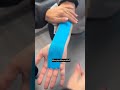 Carpal tunnel syndrome #anatomy #handpain #physiotherapist #wristpain #tenniselbow #happyrepublicday