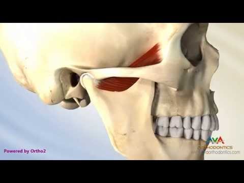 Video: Poremećaji Temporomandibularnog Zgloba U Pasa