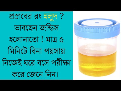 ভিডিও: হলুদ কি?