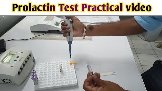 Prolactin Test practical video|| Full procedure with explanation @Lab_tech_Guru_kundan_Singh