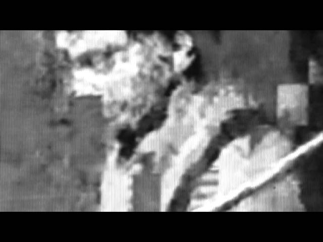 #subject 0045-49-23_Rebetron (Rebetol and Intron A Combination Therapy)- FDA#