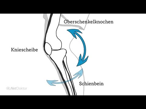 So funktioniert unser Kniegelenk - NetDoktor.de