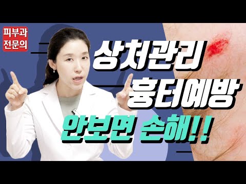 (*Eng) 흉터 안남는 상처관리법 핵심(여드름흉터, 넘어진상처, 화상물집, 베인상처) - 피부과전문의 [닥터필러]