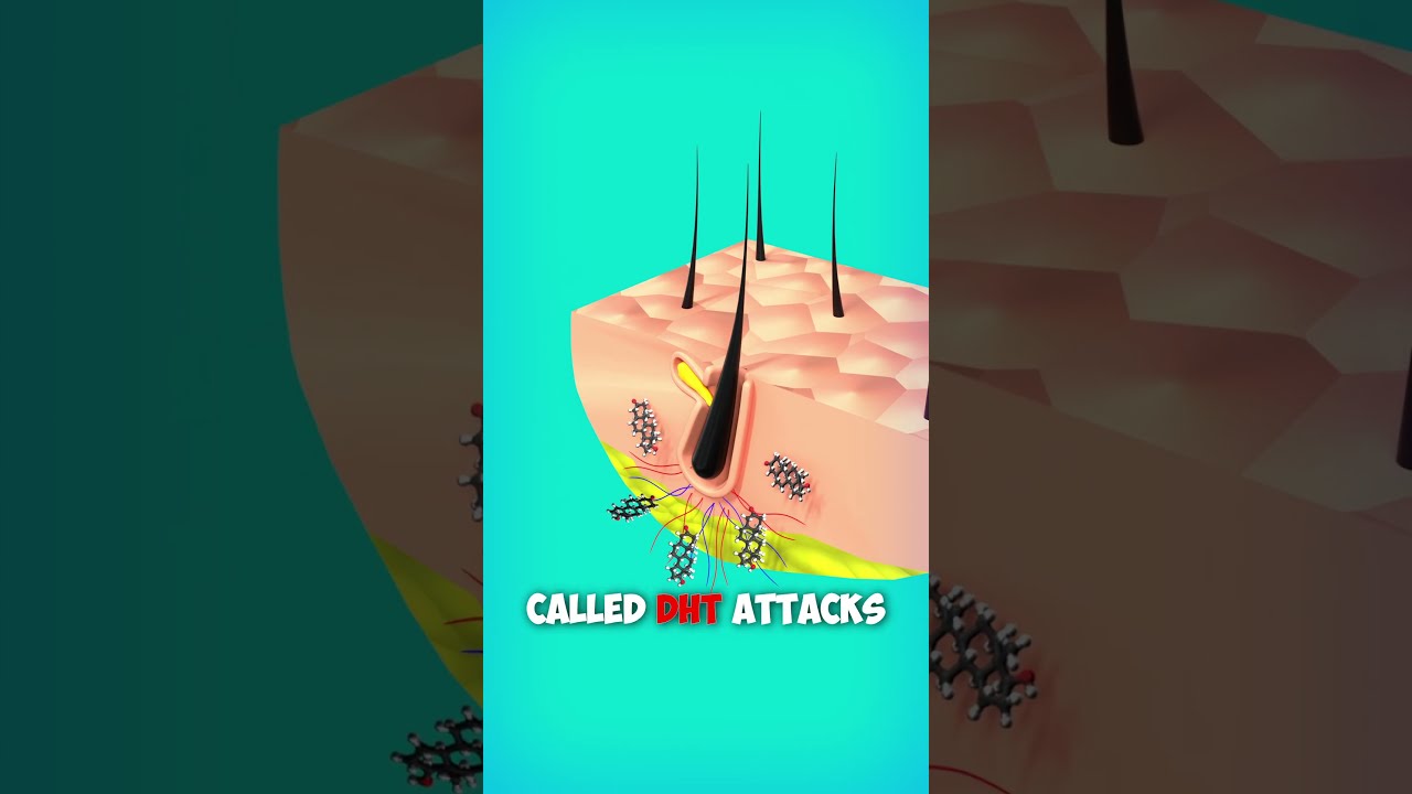 Why Hair Loss? Explained with 3d Animation. #shorts #animation #hair #education
