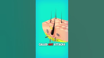 Thumbnail of Why Hair Loss? Explained with 3d Animation. #shorts #animation #hair #education