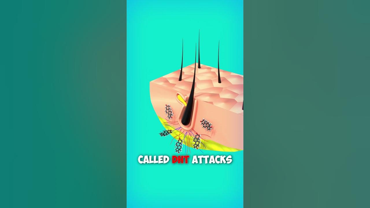 Why Hair Loss? Explained with 3d Animation. #shorts #animation #hair #education