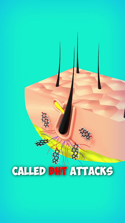 Why Hair Loss? Explained with 3d Animation. #shorts #animation #hair #education